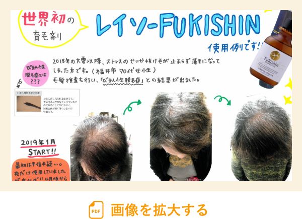 Fukishinお客様使用例(70代女性)の画像